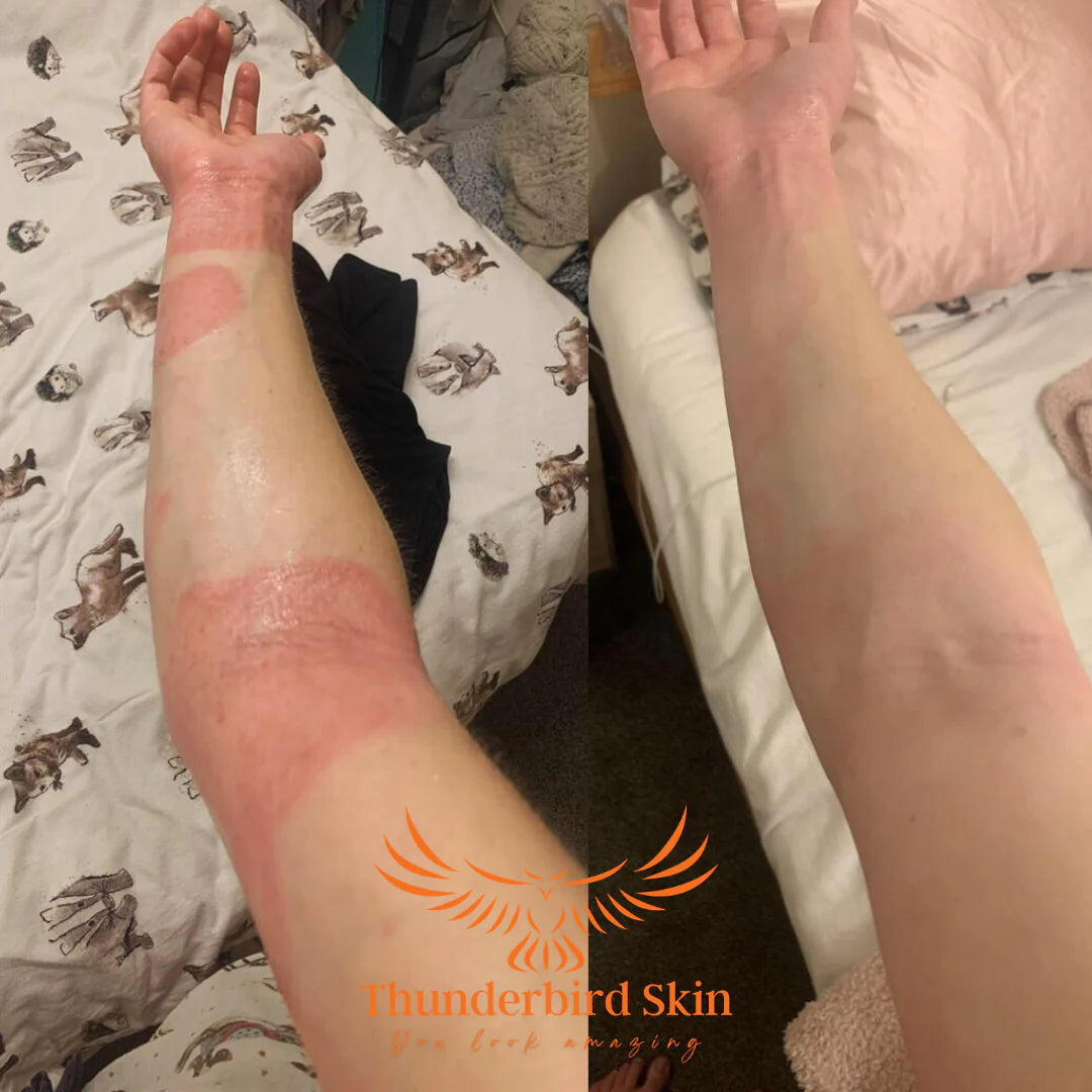 Thunderbird Skin Rescue Balm Dont Scratch